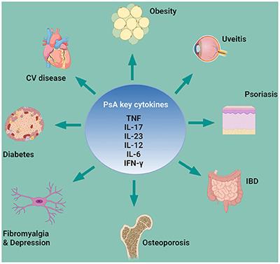 Extra-Articular Manifestations and Comorbidities in Psoriatic Disease: A Journey Into the Immunologic Crosstalk